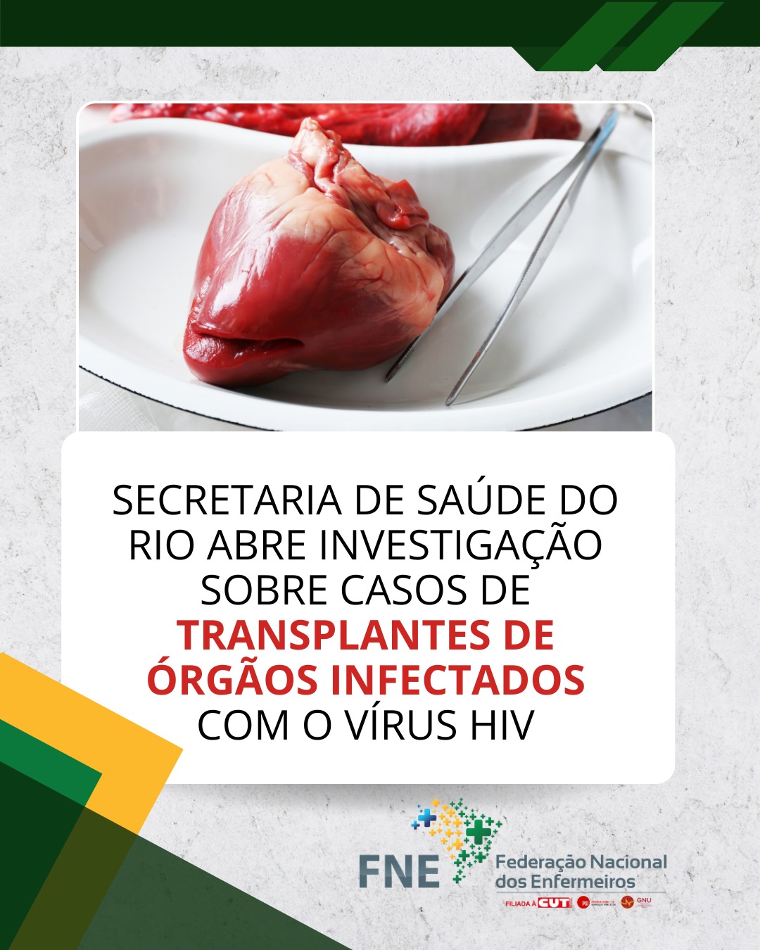 Secretaria Estadual de Saúde do Rio de Janeiro abre investigação sobre casos de transplantes de órgãos infectados com o vírus HIV